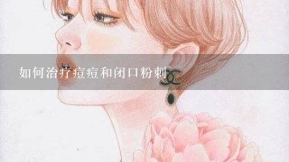 如何治疗痘痘和闭口粉刺