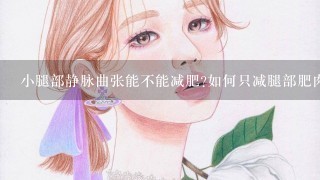 小腿部静脉曲张能不能减肥?如何只减腿部肥肉?