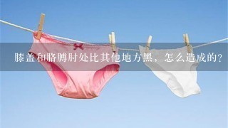 膝盖和胳膊肘处比其他地方黑，怎么造成的？怎样使它变白？如果需要使用相关护肤品，请推荐一下牌子和价钱