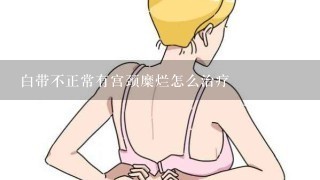 白带不正常有宫颈糜烂怎么治疗