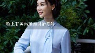 脸上有黄褐斑如何治疗好