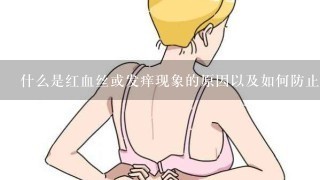 什么是红血丝或发痒现象的原因以及如何防止它们发生？