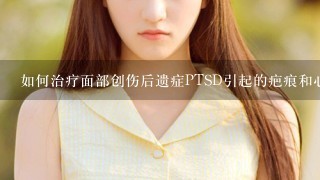 如何治疗面部创伤后遗症PTSD引起的疤痕和心理障碍？