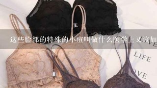 这些脸部的特殊的小痘叫做什么医学上又该如何定义