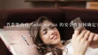 芦荟能治疗 facial eczema 的安全性如何确定?