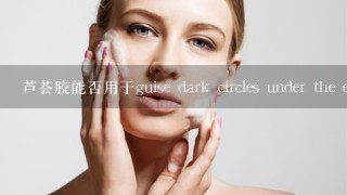 芦荟胶能否用于guise dark circles under the eyes caused by stress?