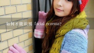 如何才能识别 facial eczema?